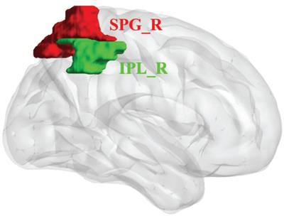 Parietal Lobe Reorganization and Widespread Functional Connectivity Integration in Upper-Limb Amputees: A rs-fMRI Study